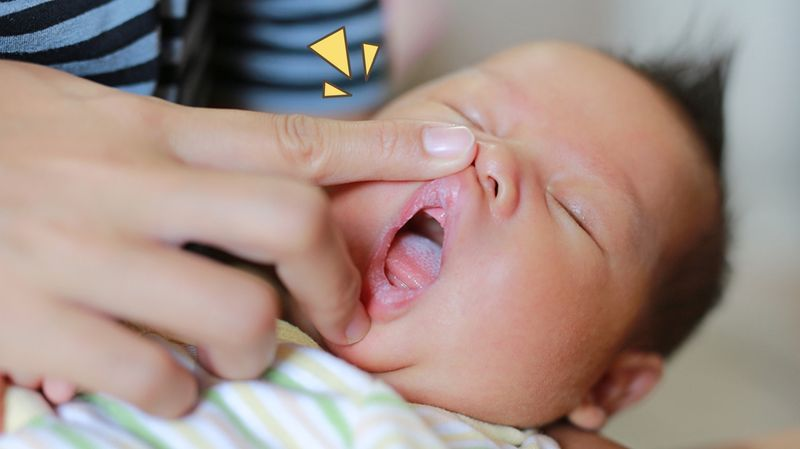 Tips Mengatasi Bibir Sariawan Pada Anak Balita
