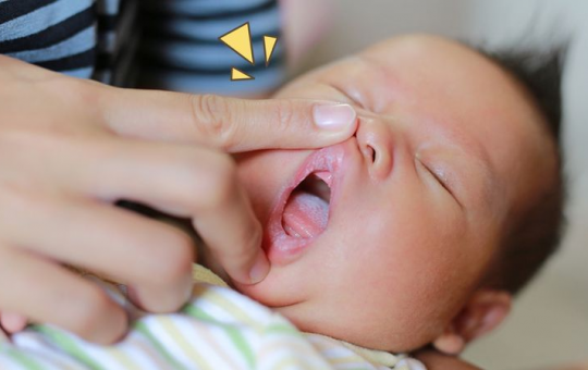 Tips Mengatasi Bibir Sariawan Pada Anak Balita
